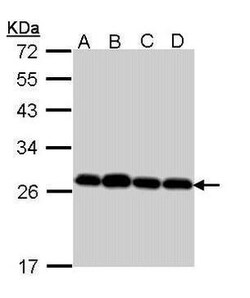 Invitrogen PRDX3 Polyclonal Antibody 100 &mu;L; Unconjugated:Antibodies,