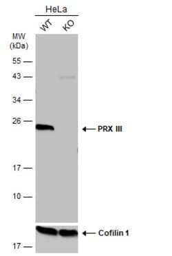 Invitrogen PRDX3 Polyclonal Antibody 100 &mu;L; Unconjugated:Anticuerpos