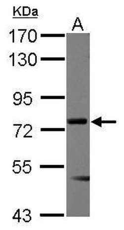Invitrogen Menin Polyclonal Antibody 100 &mu;L; Unconjugated:Antibodies,