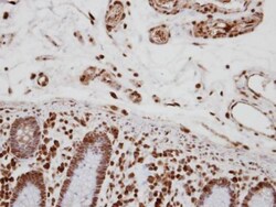 Invitrogen CA150 Polyclonal Antibody 100 &mu;L | Buy Online | Invitrogen&trade; | Fisher Scientific