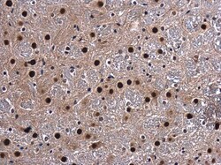 Invitrogen CA150 Polyclonal Antibody 100 &mu;L | Buy Online | Invitrogen&trade; | Fisher Scientific