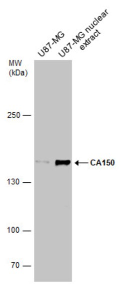 Invitrogen CA150 Polyclonal Antibody 100 &mu;L | Buy Online | Invitrogen&trade; | Fisher Scientific