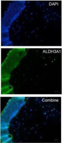 Invitrogen ALDH3A1 Polyclonal Antibody 100 &mu;L; Unconjugated:Antibodies,