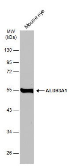 Invitrogen ALDH3A1 Polyclonal Antibody 100 &mu;L; Unconjugated:Antibodies,