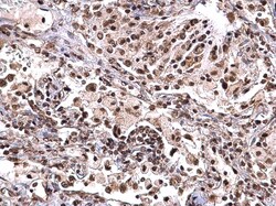 Invitrogen NPM1 Polyclonal Antibody 100 &mu;L; Unconjugated:Antibodies,