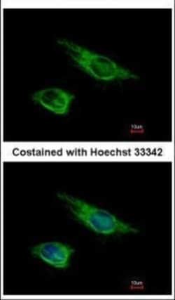 Invitrogen Vimentin Polyclonal Antibody 100 &mu;L | Buy Online | Invitrogen&trade; | Fisher Scientific