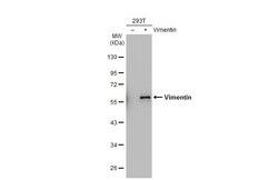 Invitrogen Vimentin Polyclonal Antibody 100 &mu;L | Buy Online | Invitrogen&trade; | Fisher Scientific