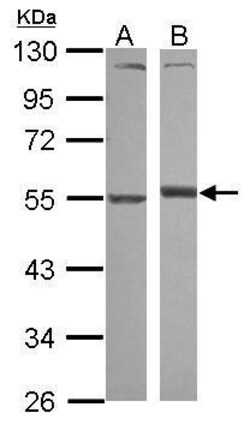 Invitrogen alpha-1 Antitrypsin Polyclonal Antibody 100 &mu;L; Unconjugated:Antibodies,