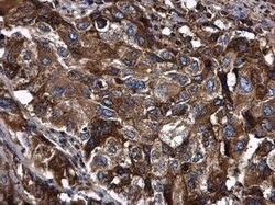 Invitrogen alpha-1 Antitrypsin Polyclonal Antibody 100 &mu;L; Unconjugated:Antibodies,