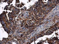 Invitrogen alpha-1 Antitrypsin Polyclonal Antibody 100 &mu;L; Unconjugated:Antibodies,