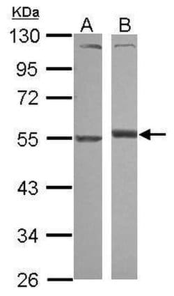 Invitrogen alpha-1 Antitrypsin Polyclonal Antibody 100 &mu;L; Unconjugated:Antibodies,