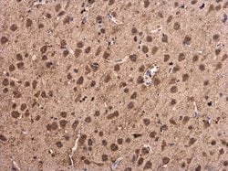 alpha Synuclein Polyclonal Antibody:Antibodies, Polyclonal