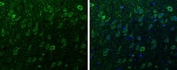 alpha Synuclein Polyclonal Antibody:Antibodies, Polyclonal