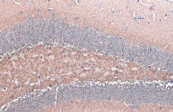 alpha Synuclein Polyclonal Antibody:Antibodies, Polyclonal
