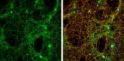 alpha Synuclein Polyclonal Antibody:Antibodies, Polyclonal