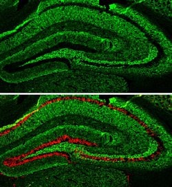 alpha Synuclein Polyclonal Antibody:Antibodies, Polyclonal