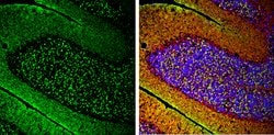 alpha Synuclein Polyclonal Antibody:Antibodies, Polyclonal