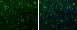alpha Synuclein Polyclonal Antibody:Antibodies, Polyclonal