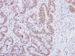 alpha Synuclein Polyclonal Antibody:Antibodies, Polyclonal
