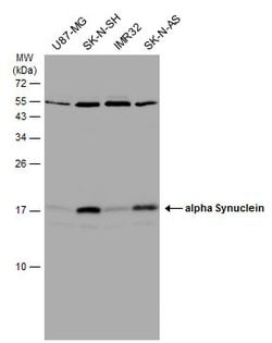 alpha Synuclein Polyclonal Antibody:Antibodies, Polyclonal