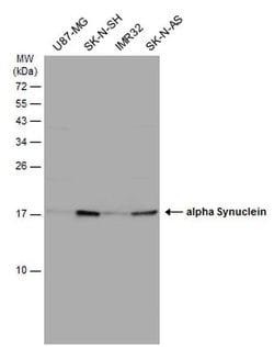 alpha Synuclein Polyclonal Antibody:Antibodies, Polyclonal