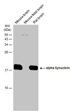 alpha Synuclein Polyclonal Antibody:Antibodies, Polyclonal