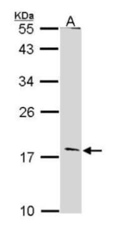 Invitrogen Glucagon Polyclonal Antibody 100 &mu;L; Unconjugated:Antibodies,