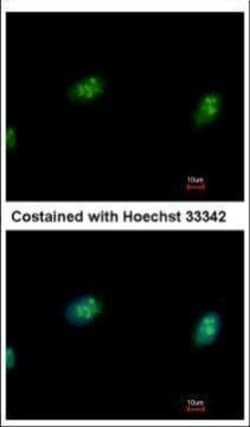 Invitrogen CDK4 Polyclonal Antibody 100 &mu;L; Unconjugated:Antibodies,