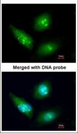 Invitrogen CDK4 Polyclonal Antibody 100 &mu;L; Unconjugated:Antibodies,