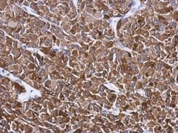 Invitrogen HSP27 Polyclonal Antibody 100 &mu;L | Buy Online | Invitrogen&trade; | Fisher Scientific
