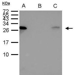 Invitrogen HSP27 Polyclonal Antibody 100 &mu;L | Buy Online | Invitrogen&trade; | Fisher Scientific