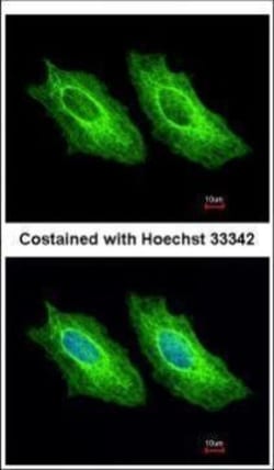 Invitrogen Cytokeratin 18 Polyclonal Antibody 100 &mu;L; Unconjugated:Antibodies,