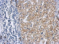 Invitrogen Cytokeratin 18 Polyclonal Antibody 100 &mu;L; Unconjugated:Antibodies,