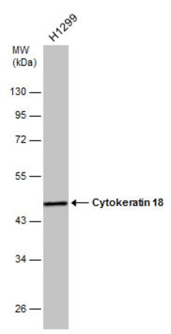 Invitrogen Cytokeratin 18 Polyclonal Antibody 100 &mu;L; Unconjugated:Antibodies,