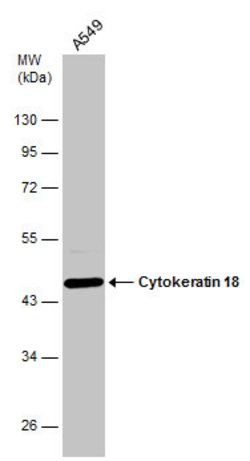 Invitrogen Cytokeratin 18 Polyclonal Antibody 100 &mu;L; Unconjugated:Antibodies,