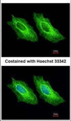 Invitrogen Cytokeratin 18 Polyclonal Antibody 100 &mu;L; Unconjugated:Antibodies,