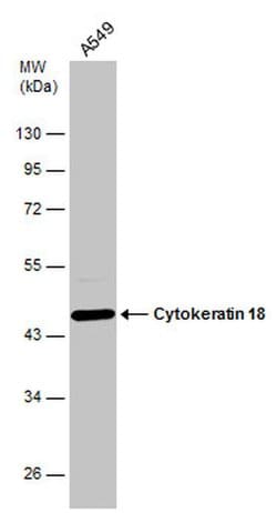 Invitrogen Cytokeratin 18 Polyclonal Antibody 100 &mu;L; Unconjugated:Antibodies,