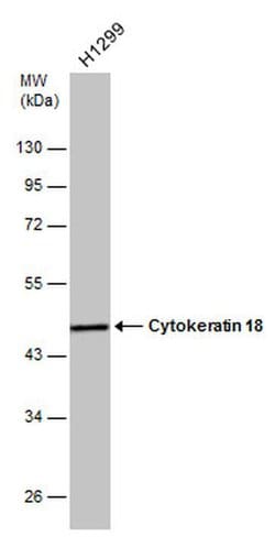 Invitrogen Cytokeratin 18 Polyclonal Antibody 100 &mu;L; Unconjugated:Antibodies,