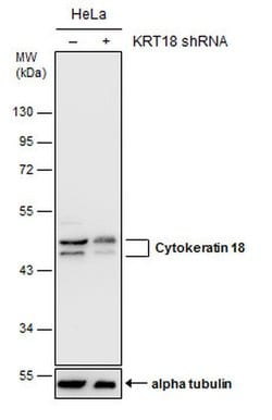 Invitrogen Cytokeratin 18 Polyclonal Antibody 100 &mu;L; Unconjugated:Antibodies,