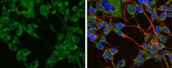 Invitrogen Tyrosine Hydroxylase Polyclonal Antibody 100 &mu;L; Unconjugated:Antibodies,