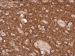 Invitrogen Tyrosine Hydroxylase Polyclonal Antibody 100 &mu;L; Unconjugated:Antibodies,