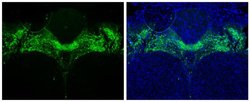 Invitrogen Tyrosine Hydroxylase Polyclonal Antibody 100 &mu;L; Unconjugated:Antibodies,