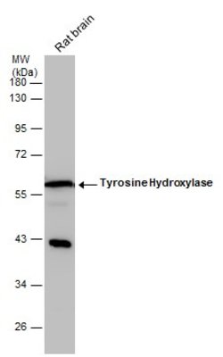 Invitrogen Tyrosine Hydroxylase Polyclonal Antibody 100 &mu;L; Unconjugated:Antibodies,