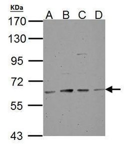 Invitrogen Tyrosine Hydroxylase Polyclonal Antibody 100 &mu;L; Unconjugated:Antibodies,