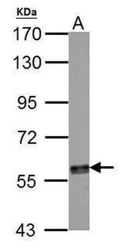 Invitrogen Tyrosine Hydroxylase Polyclonal Antibody 100 &mu;L; Unconjugated:Antibodies,