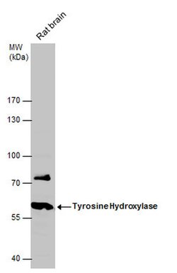 Invitrogen Tyrosine Hydroxylase Polyclonal Antibody 100 &mu;L; Unconjugated:Antibodies,