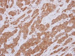 Bcl-10 Polyclonal Antibody, Invitrogen 100 &mu;L; Unconjugated:Antibodies,