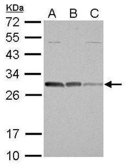 Bcl-10 Polyclonal Antibody, Invitrogen 100 &mu;L; Unconjugated:Antibodies,