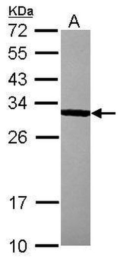 Bcl-10 Polyclonal Antibody, Invitrogen 100 &mu;L; Unconjugated:Antibodies,