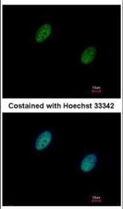 Invitrogen CHK2 Polyclonal Antibody 100 &mu;L; Unconjugated:Antibodies,